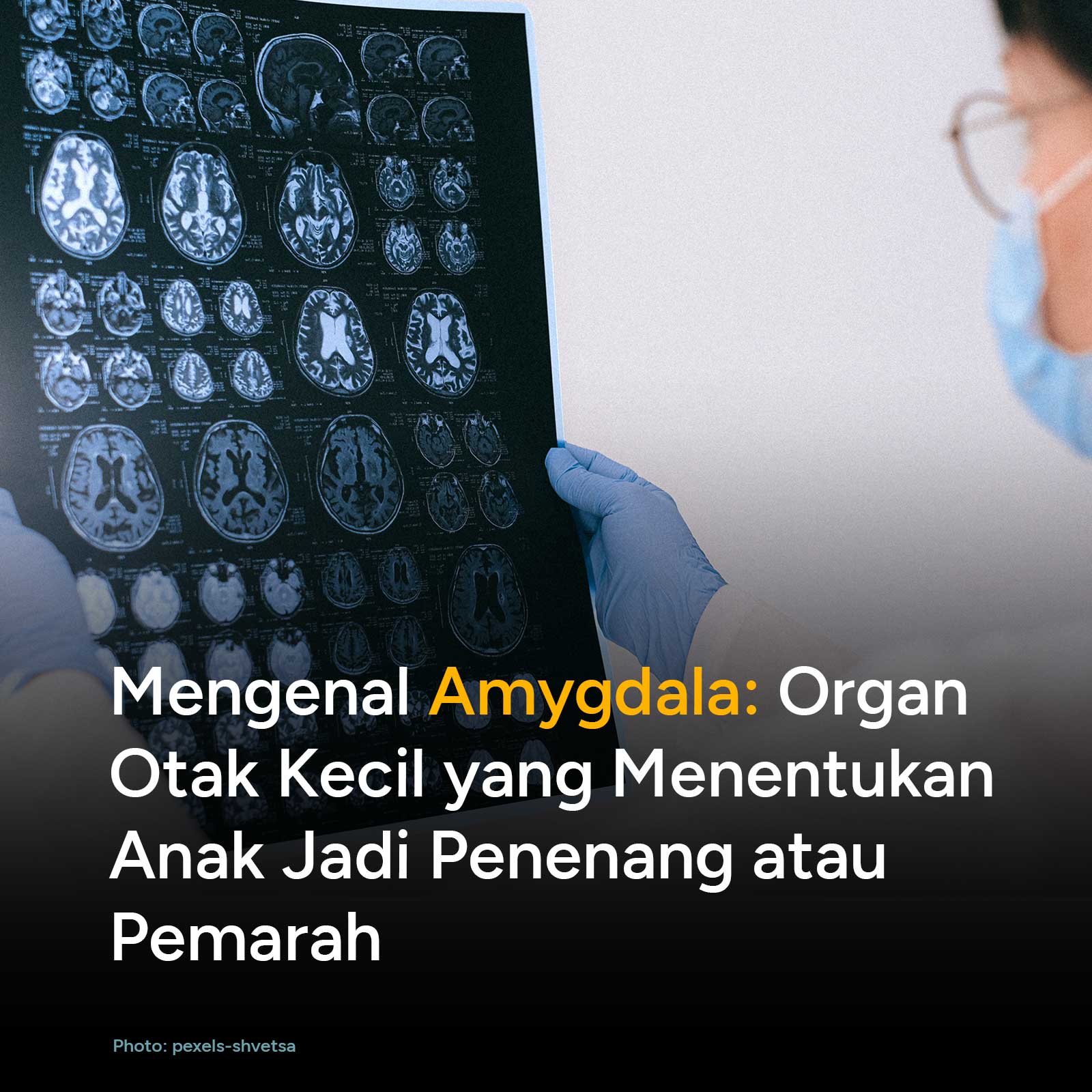 Di balik perilaku anak yang suka melempar barang, mengamuk, atau melamun saat belajar, ada mekanisme pertahanan diri purba yang bekerja di otak mereka. Ketika amygdala terpicu oleh stres berlebih, anak akan masuk ke mode 'fight or flight' (melawan atau lari). Pahami bagaimana perkembangan otak anak bekerja dan bagaimana peran orang tua dalam mengaktifkan 'rem' stres di sistem saraf mereka.